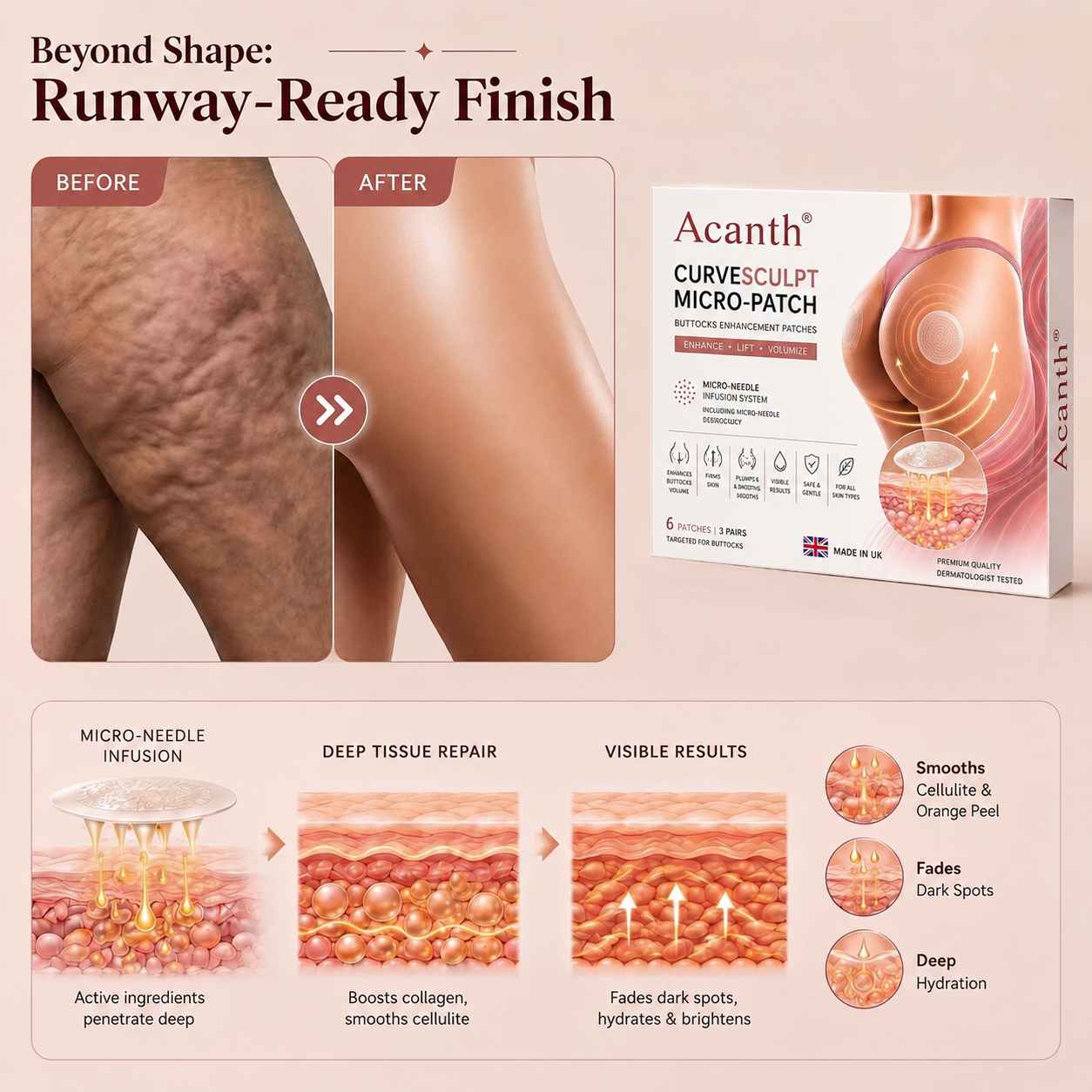 Acanth® CurveSculpt Micro-Patch ✦ Sculpt • Firm • Smooth Lower Body Curves ✦ Micro-Needle Infusion System