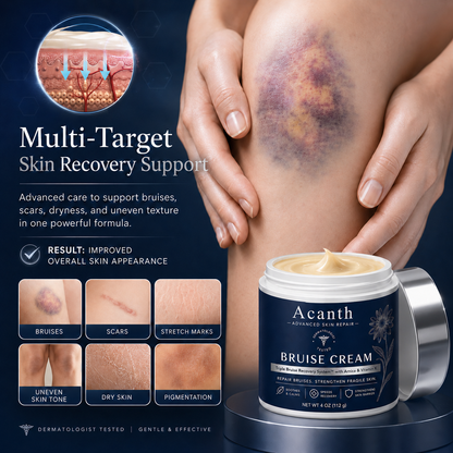 💥LAST DAY SALE 50%OFF💕- Acanth® Bruise Repair & Skin-Strengthening Cream