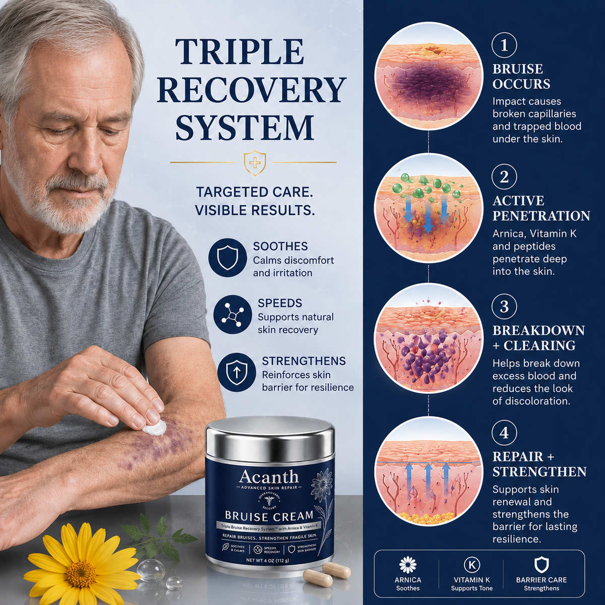 💥LAST DAY SALE 50%OFF💕- Acanth® Bruise Repair & Skin-Strengthening Cream