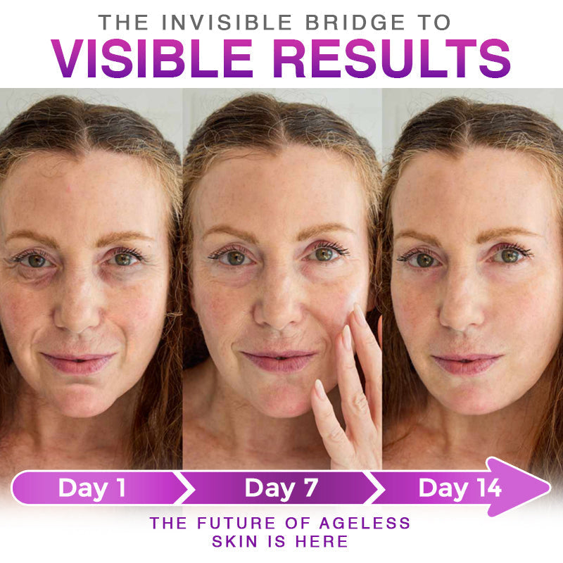 Acanth® 3-in-1 Microneedle Anti-Aging Patch