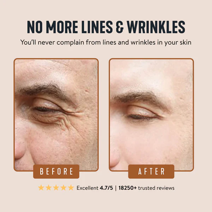 🔥Limited Time Offer 🔥Wrinkle Defense Tallow Balm