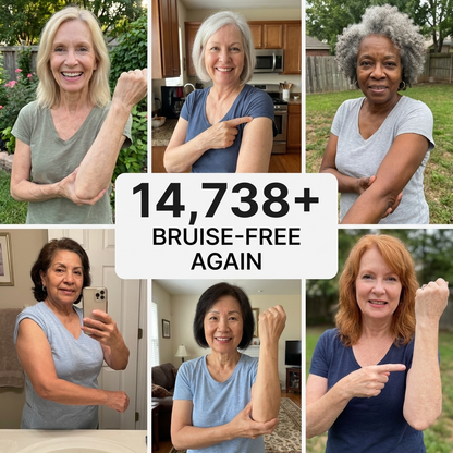 💥LAST DAY SALE 50%OFF💕- Acanth® Bruise Repair & Skin-Strengthening Cream
